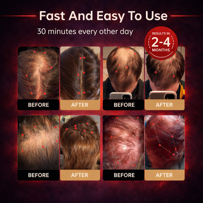 Bloomcare™ Revive- Red Light Therapy Regrowth Cap